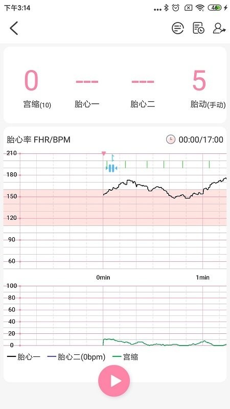 十月宝贝胎心监护医生