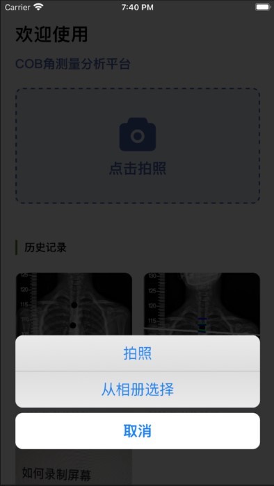 cobb角测量分析平台app