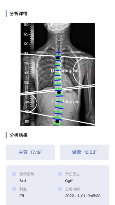 cobb角测量分析平台app