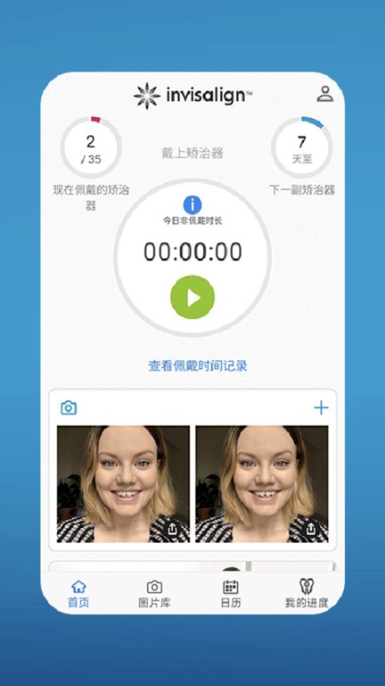 my invisalign 最新版本